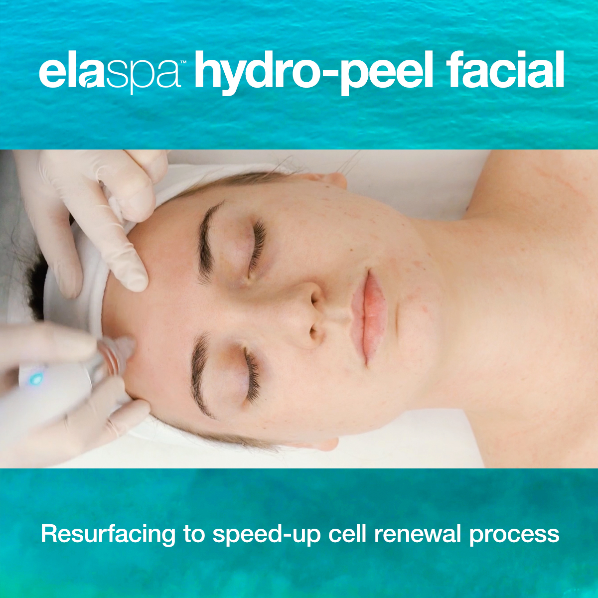 FREE Customized Enzyme Peel With A 75 Min Facial