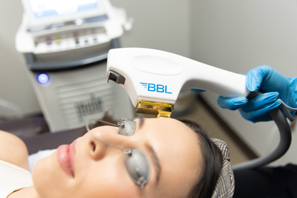 Get 30% off Your First Sciton Laser Treatment